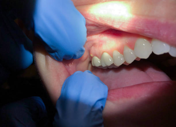 Best Tooth Pain Emergency Relief  in Bowman, ND